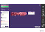 create dental restorations using exocad